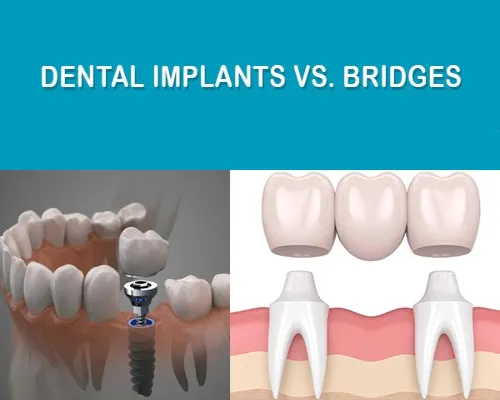 Missing teeth treatment